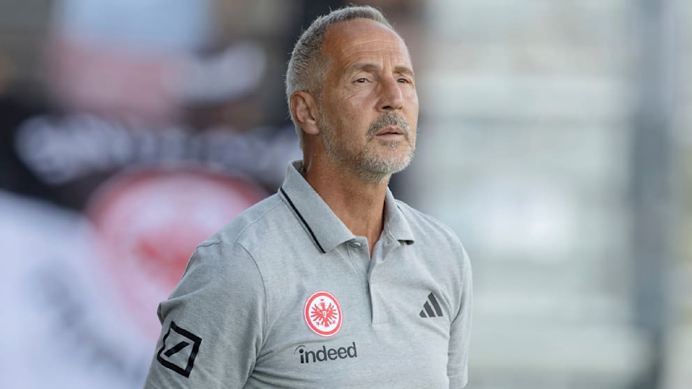 Adi Hütter’den Brentford Bozgunu Sonrası Sert Uyarı