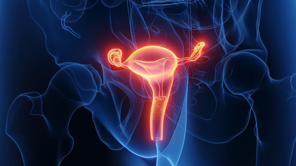 Geniş Kapsamlı Araştırma: Endometriose Hastalarında Tip-2 Diyabet Riski Daha Yüksek